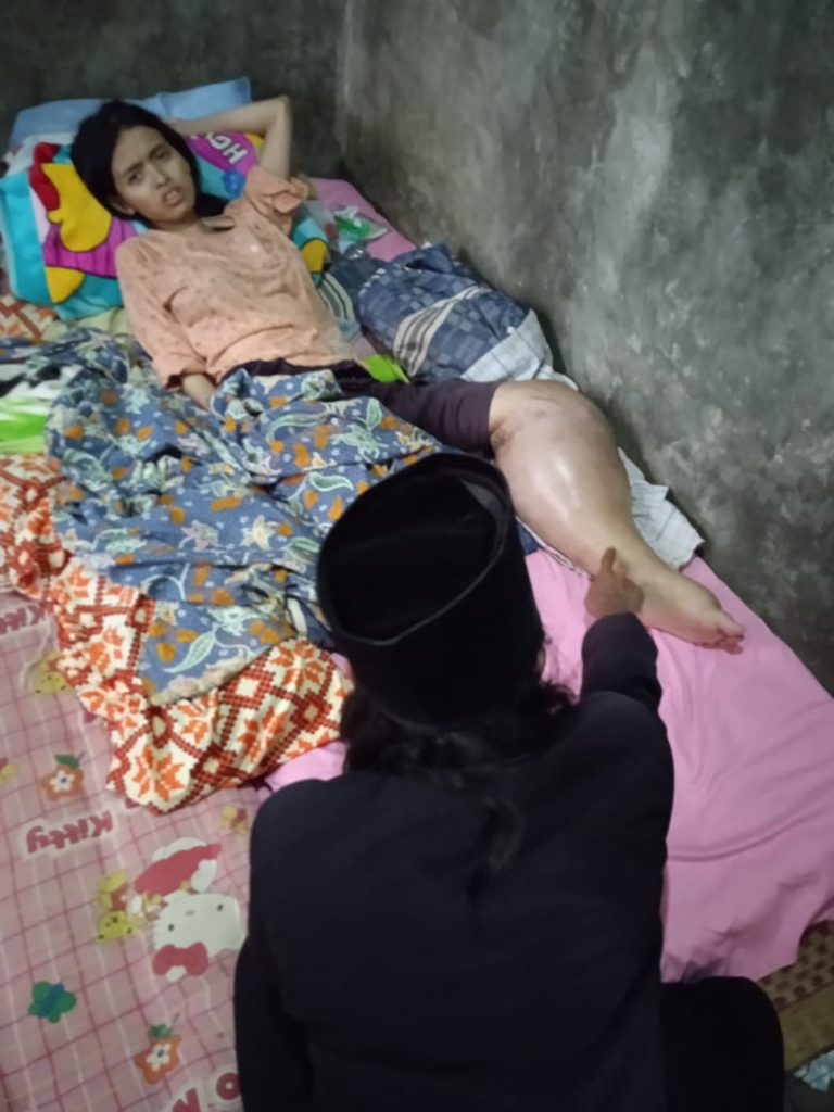 Peduli Kasih, Deuis Pengidap Tumor Ganas Tasikmalaya