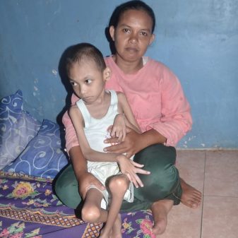 Anugrah Adeling Darusalam Warga Blok Tegal Bedug, Penderita Pengecilan Otak