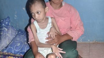 Anugrah Adeling Darusalam Warga Blok Tegal Bedug, Penderita Pengecilan Otak