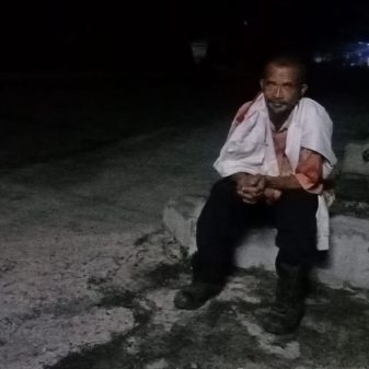 Tambal Hotmix Jalan Negara Dekat Kantor Lurah Mataloko,  Tiga Hari 5 Lakalantas