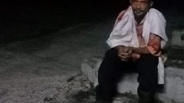 Tambal Hotmix Jalan Negara Dekat Kantor Lurah Mataloko,  Tiga Hari 5 Lakalantas