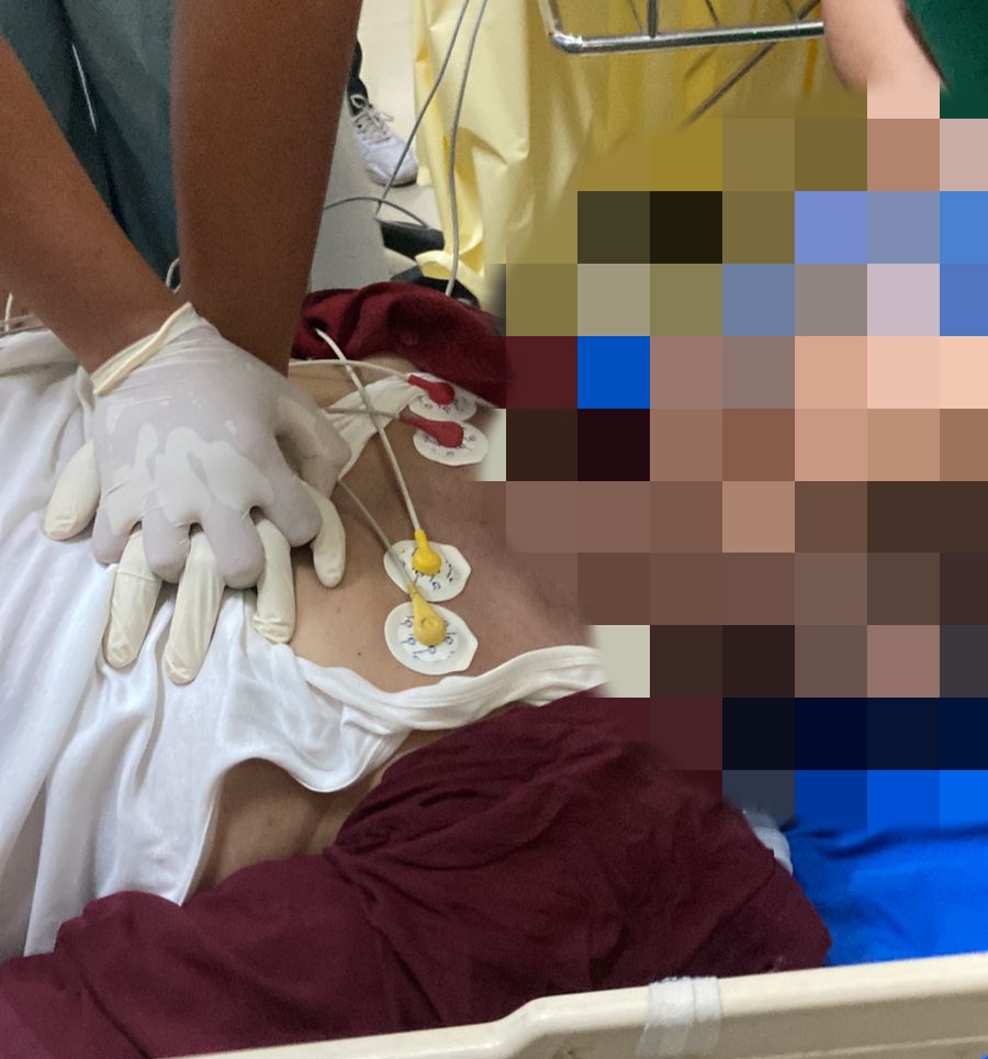 Mantan Bupati Kuningan Acep Purnama, Keritis Diduga Kena Serangan Jantung